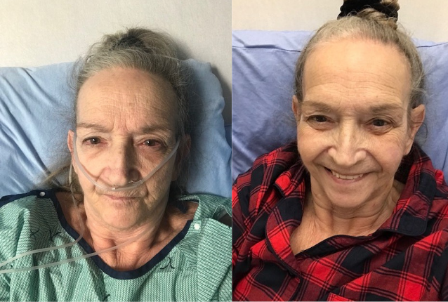 Lynda before and after transplant